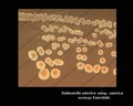 salmonella enterica